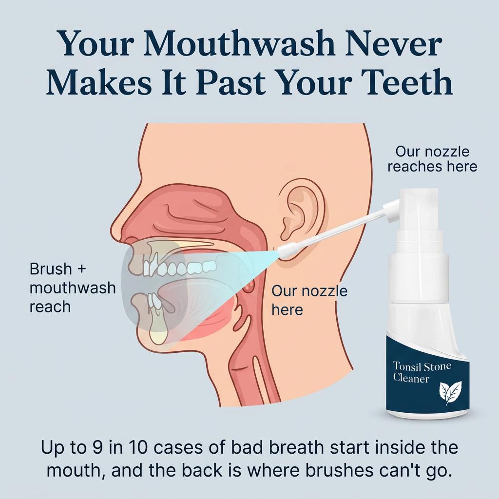 Your mouthwash never makes it past your teeth: the nozzle reaches the tonsils